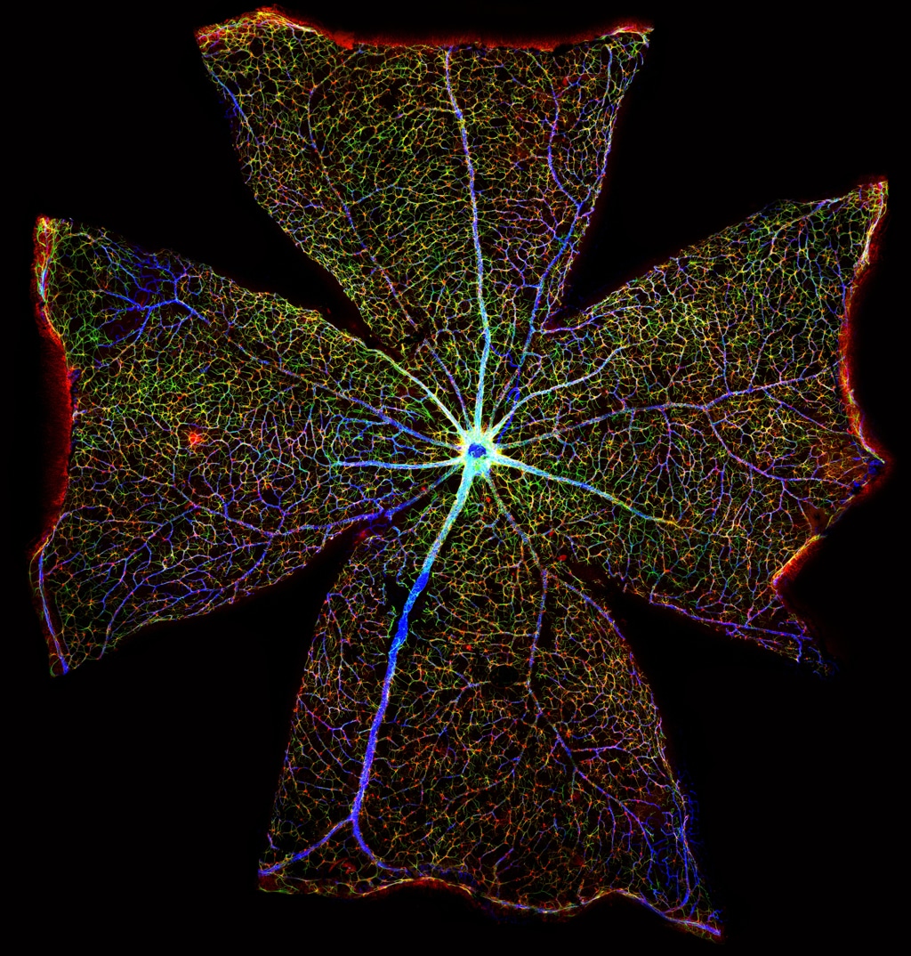 The reconstruction of the entire surface of the retina of a mouse, digitally realized using over 400 images (Gabriel Luna, Neuroscience Research Institute, University of California, Santa Barbara).